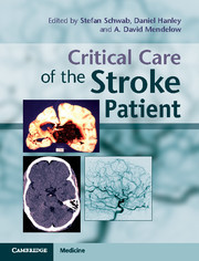 Couverture de l’ouvrage Critical Care of the Stroke Patient