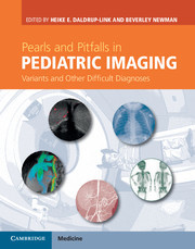 Couverture de l’ouvrage Pearls and Pitfalls in Pediatric Imaging