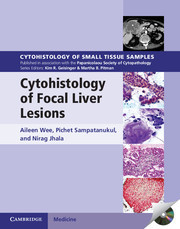Couverture de l’ouvrage Cytohistology of Focal Liver Lesions