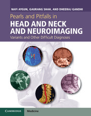 Cover of the book Pearls and Pitfalls in Head and Neck and Neuroimaging