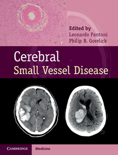 Couverture de l’ouvrage Cerebral Small Vessel Disease