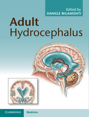 Couverture de l’ouvrage Adult Hydrocephalus