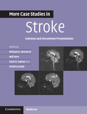 Couverture de l’ouvrage More Case Studies in Stroke
