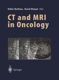 Couverture de l’ouvrage CT and MRI in Oncology