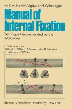 Couverture de l’ouvrage Manual of Internal Fixation
