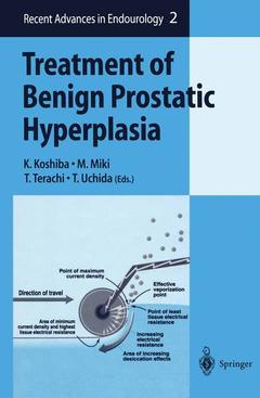 Couverture de l’ouvrage Treatment of Benign Prostatic Hyperplasia