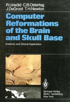 Couverture de l’ouvrage Computer Reformations of the Brain and Skull Base