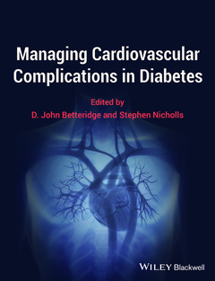 Couverture de l’ouvrage Managing Cardiovascular Complications in Diabetes