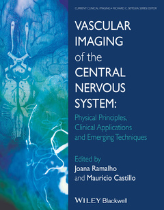 Couverture de l’ouvrage Vascular Imaging of the Central Nervous System