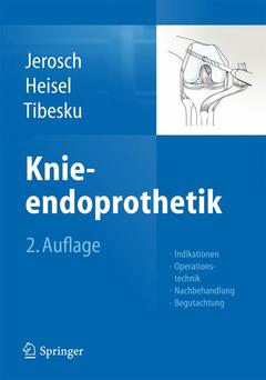 Couverture de l’ouvrage Knieendoprothetik