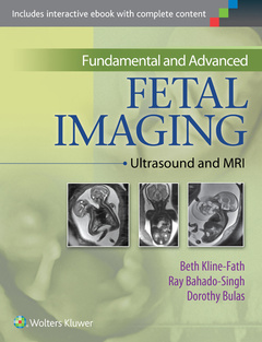 Couverture de l’ouvrage Fundamental and Advanced Fetal Imaging