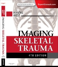 Couverture de l’ouvrage Imaging Skeletal Trauma