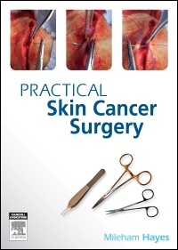 Couverture de l’ouvrage Practical Skin Cancer Surgery