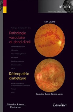 Couverture de l'ouvrage Pathologie vasculaire du fond d'oeil / Rétinopathie diabétique 