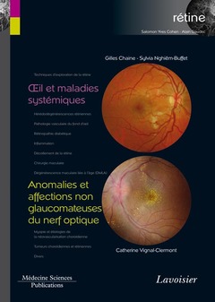 Couverture de l’ouvrage Œil et maladies systémiques / Anomalies et affections non glaucomateuses du nerf optique
