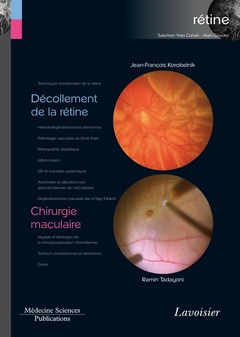 Couverture de l’ouvrage Décollement de la rétine / Chirurgie maculaire