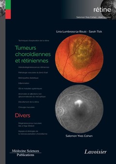 Couverture de l’ouvrage Tumeurs choroïdiennes et rétiniennes / Divers 