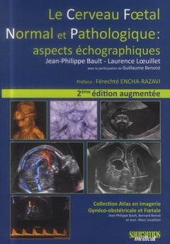 Couverture de l’ouvrage Le cerveau foetal normal et pathologique