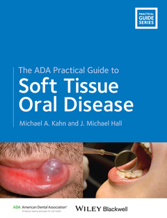 Couverture de l’ouvrage The ADA Practical Guide to Soft Tissue Oral Disease
