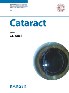 Couverture de l’ouvrage Cataract