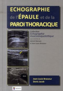 Couverture de l’ouvrage ECHOGRAPHIE DE L'EPAULE ET DE LA PAROI THORACIQUE
