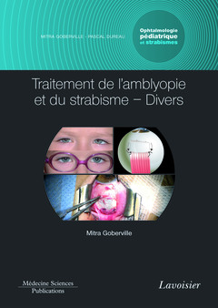 Couverture de l’ouvrage Traitement de l'amblyopie et du strabisme - Divers