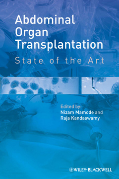 Cover of the book Abdominal Organ Transplantation