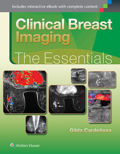 Couverture de l’ouvrage Clinical Breast Imaging: The Essentials