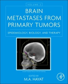 Couverture de l’ouvrage Brain Metastases from Primary Tumors, Volume 2
