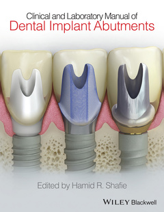 Cover of the book Clinical and Laboratory Manual of Dental Implant Abutments