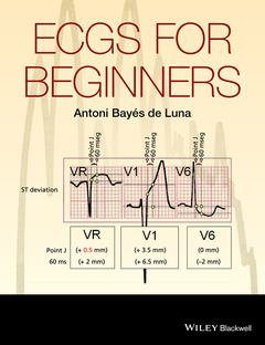 Cover of the book ECGs for Beginners