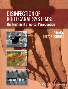 Couverture de l’ouvrage Disinfection of Root Canal Systems