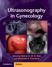 Cover of the book Ultrasonography in Gynecology