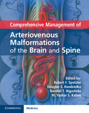 Couverture de l’ouvrage Comprehensive Management of Arteriovenous Malformations of the Brain and Spine