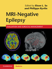 Couverture de l’ouvrage MRI-Negative Epilepsy