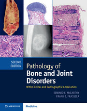 Couverture de l’ouvrage Pathology of Bone and Joint Disorders Print and Online Bundle
