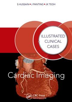 Couverture de l’ouvrage Cardiac Imaging