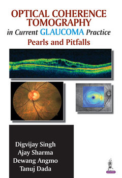 Cover of the book Optical Coherence Tomography in Current Glaucoma Practice