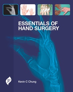 Couverture de l’ouvrage Essentials of Hand Surgery