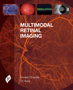 Couverture de l’ouvrage Multimodal Retinal Imaging
