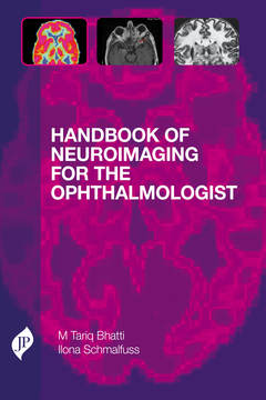 Couverture de l’ouvrage Handbook of Neuroimaging for the Ophthalmologist