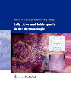 Couverture de l’ouvrage Fallstricke und Fehlerquellen in der Dermatologie