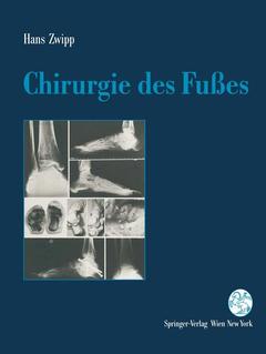 Cover of the book Chirurgie des Fußes