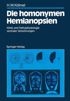 Cover of the book Die homonymen Hemianopsien
