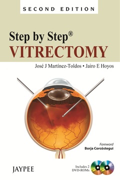 Couverture de l’ouvrage Step by Step: Vitrectomy