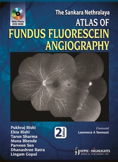 Couverture de l’ouvrage Atlas of Fundus Fluorescein Angiography