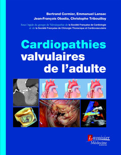 Couverture de l’ouvrage Cardiopathies valvulaires de l'adulte