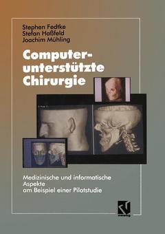 Couverture de l’ouvrage Computerunterstützte Chirurgie