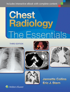 Couverture de l’ouvrage Chest Radiology: The Essentials