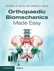 Cover of the book Orthopaedic Biomechanics Made Easy